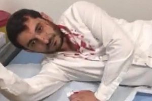 DP meclis &uuml;yesine kuzeni saldırdı
