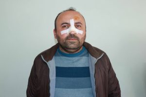 Ekmeği ucuz sattığı i&ccedil;in dayak atıp burnunu kırdılar