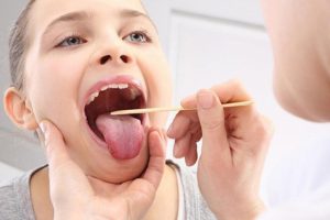Bademcik iltihabı nasıl ge&ccedil;er? İşte cevabı