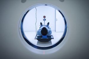 Prof. Dr. &Ccedil;akmur: Parkinson hasta sayısı 2030'da 30 milyona ulaşacak