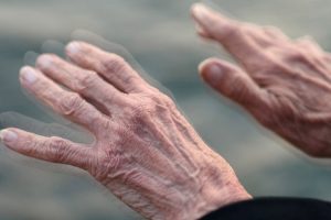 "Parkinson cerrahisinde hasta se&ccedil;imi &ouml;nem taşıyor"