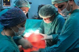 Karnından 13 kiloluk kitle &ccedil;ıkarıldı! "&Uuml;zerimden b&uuml;y&uuml;k bir y&uuml;k kalktı"