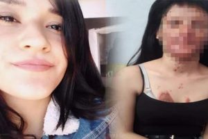 Nişanlısı, y&uuml;z&uuml;n&uuml; tanınmaz hale getirdi!
