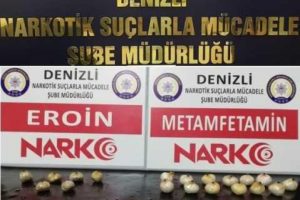 Mide ve bağırsaklarından &ccedil;ıkanlar şok etti!