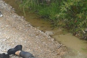 Baygınlık ge&ccedil;iren gen&ccedil; kadın y&uuml;z&uuml;st&uuml; su birikintisine d&uuml;şt&uuml;