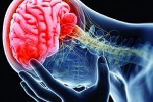 Alzheimer'a &ccedil;ok benzeyen yeni bir bunama t&uuml;r&uuml; keşfedildi