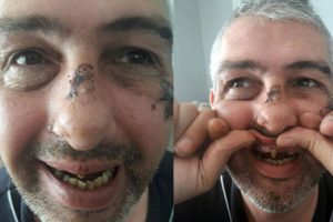 Saldırganlar, sigara ve bisikletini vermeyen adamın dişlerini s&ouml;kt&uuml;