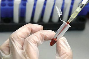 Dakikalar i&ccedil;inde bakteri &ouml;l&ccedil;en cihaz