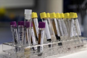 Bir d&ouml;nem &ouml;ld&uuml;ren genetik hastalık &ouml;nlenebilir hale geldi