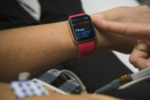 Apple Watch EKG &ouml;zelliğinin sınırları genişledi