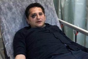 Korumaların darp ettiği avukatla ilgili flaş gelişme!