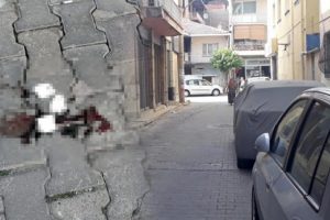 Arkadaşı tarafından başından vurulan gen&ccedil;, ağır yaralandı