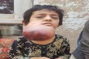 Afganistanlı k&uuml;&ccedil;&uuml;k Habibe yardım bekliyor