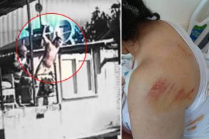 Odun kesen komşu kadını d&ouml;v&uuml;p, nacakla saldırdı