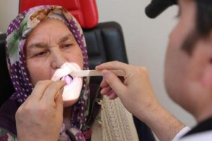 Kırılan dişlerinden dil kanseri oldu