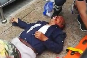 Karşıya ge&ccedil;erken tramvay &ccedil;arptı