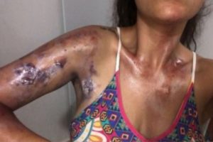 Fenomen gelin adayı &ouml;l&uuml;mden d&ouml;nd&uuml;
