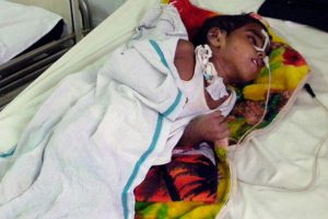 Hindistan'da ensefalit nedeniyle 83 kişi hayatını kaybetti
