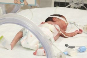 T&uuml;rkiye'de bebek &ouml;l&uuml;mlerinde d&uuml;ş&uuml;ş