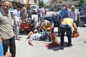 Feci kazada motosiklet s&uuml;r&uuml;c&uuml;s&uuml;n&uuml;n ayağı koptu!