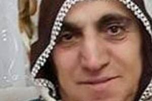Arı sokunca canında oldu