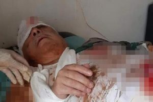 Ter&ouml;rist Mihra&ccedil; Ural'ın patlamada yaralandığı iddia edildi