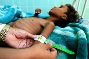Yemen'deki kolera salgını 200 binden fazla &ccedil;ocuğu vurdu