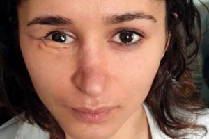 23 yaş b&uuml;y&uuml;k eşi bu hale getirdi, Tuğ&ccedil;e hukuk m&uuml;cadelesi başlattı