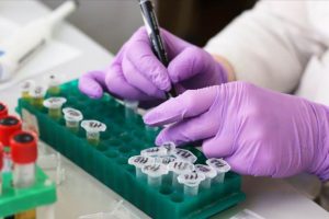 N&ouml;ronlardaki kusurlu proteinleri ayıklayan molek&uuml;l bulundu