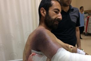 Taşla yaraladığı yılan bu hale getirdi