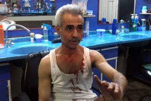 Berberi 'kadına neden baktın?' diyerek d&ouml;vd&uuml;ler