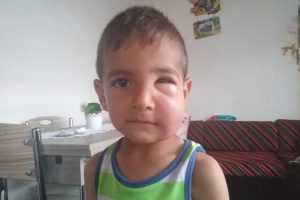 Arıların saldırdığı 2 &ccedil;ocuk hastanelik oldu