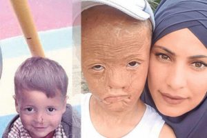 Yeni y&uuml;z i&ccedil;in gereken para toplandı