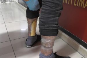 Biri bileğine bantlamış, diğeriyse malzemelerin i&ccedil;ine zulalamış