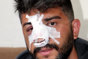 Yan bakma kavgasında yaralanan &Ouml;mer'in annesi: İzlediğim benim &ccedil;ocuğummuş