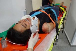 Eşi boğazından bı&ccedil;akladı, balkondan atlayıp yardım istedi