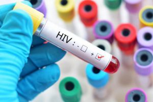Rusya'da 20 bin kişi HIV pozitif nedeniyle hayatını kaybetti