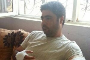 Baba ve 2 oğlu, yaban domuzlarının saldırısında yaralandı