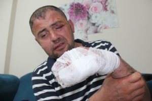 Bursa'da gaziyi gittiği kafede ayaklarını uzattı diye öldüresiye dövdüler