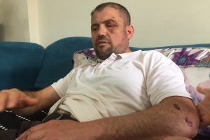 Bursa'da darp edilen gazinin 4 kaburgası kırık &ccedil;ıktı