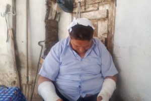 Eniştelerini hastanelik edinceye kadar odunla d&ouml;vd&uuml;ler