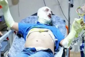 MHP İl&ccedil;e Başkanı teknede &ccedil;ıkan yangında yaralandı