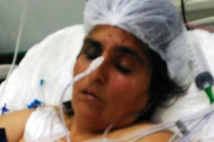 'Merdivenden d&uuml;şt&uuml;' denildi ama korkun&ccedil; ger&ccedil;ek ortaya &ccedil;ıktı!