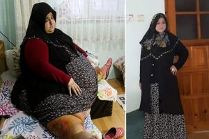 1.5 yılda 155 kilo verdi