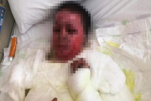 Somali'de patlamada yaralanan Hamda, kurtarılamadı