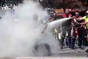 Ankara'nın g&ouml;beğinde kendisini yaktı