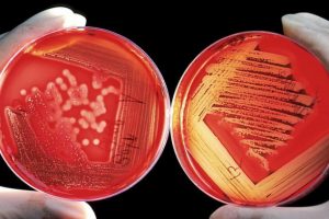 Antibiyotiklerle ilgili korkutan uyarı