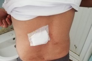 Terasta uyurken maganda kurşunu ile yaralandı