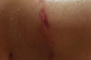 İlkokul &ouml;ğrencisi, okul d&ouml;n&uuml;ş&uuml; sokak k&ouml;peğinin saldırısına uğradı