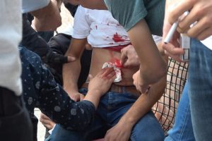 3 yerinden bı&ccedil;aklandı, yaptıklarıyla şoke etti!